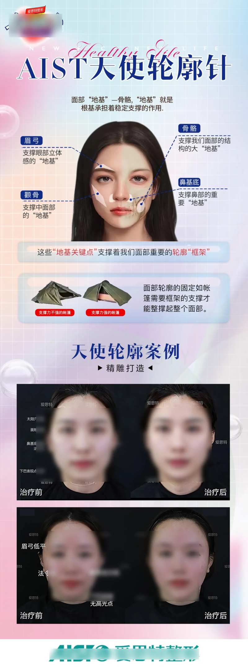 轮廓固定医美海报-采灵感-cailinggan.com