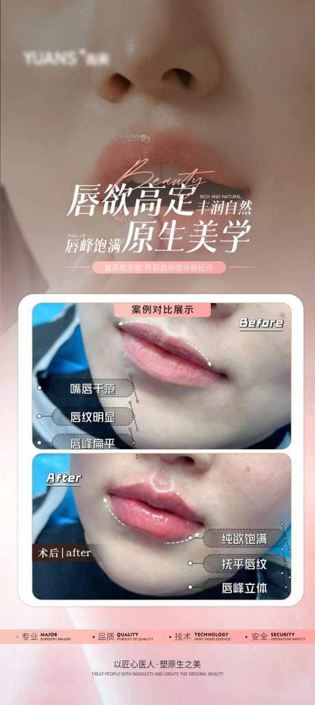 医美嘟嘟唇丰唇案例海报-采灵感-https://www.cailinggan.com/