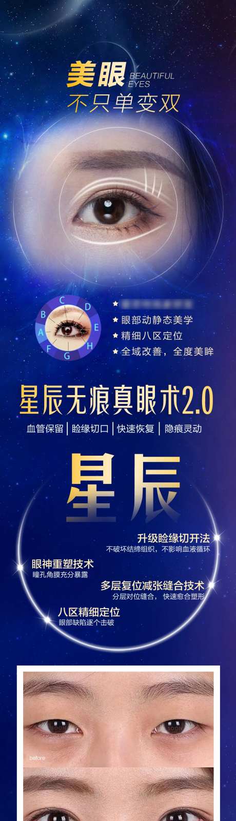 无痕双眼皮长图-采灵感-https://www.cailinggan.com/