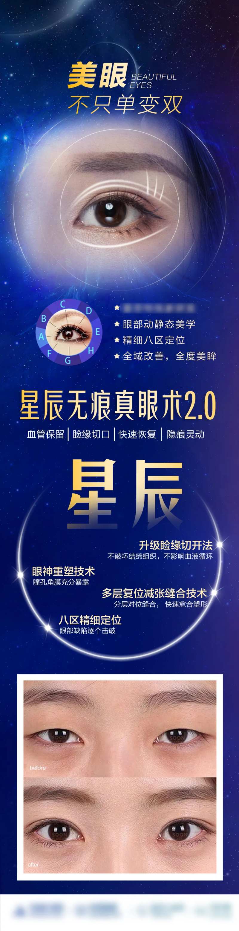 无痕双眼皮长图-采灵感-cailinggan.com