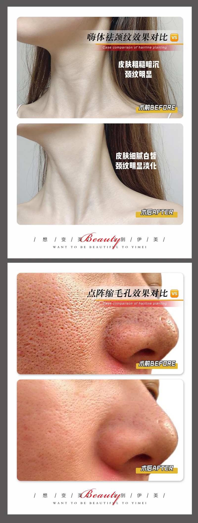 医美案例模板-采灵感-cailinggan.com