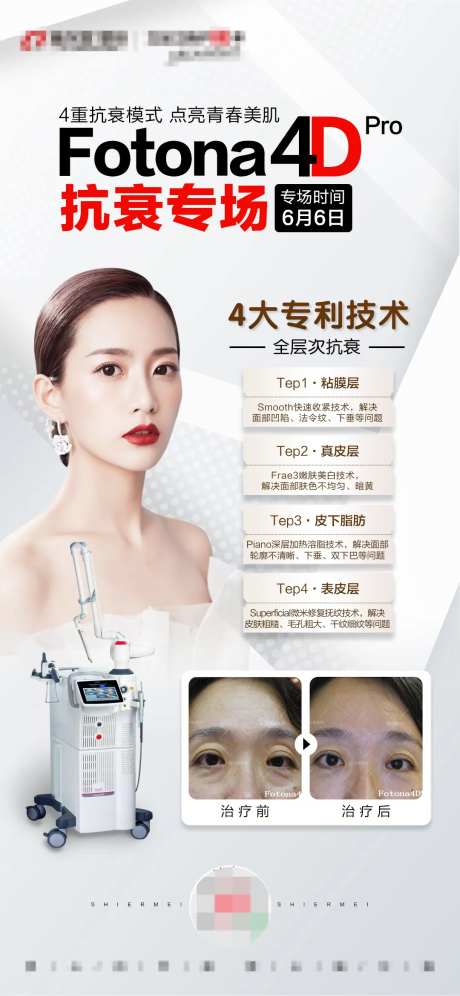 FOTONA 4D 朋友圈海报                                                                                                                                                                                         -采灵感-https://www.cailinggan.com/