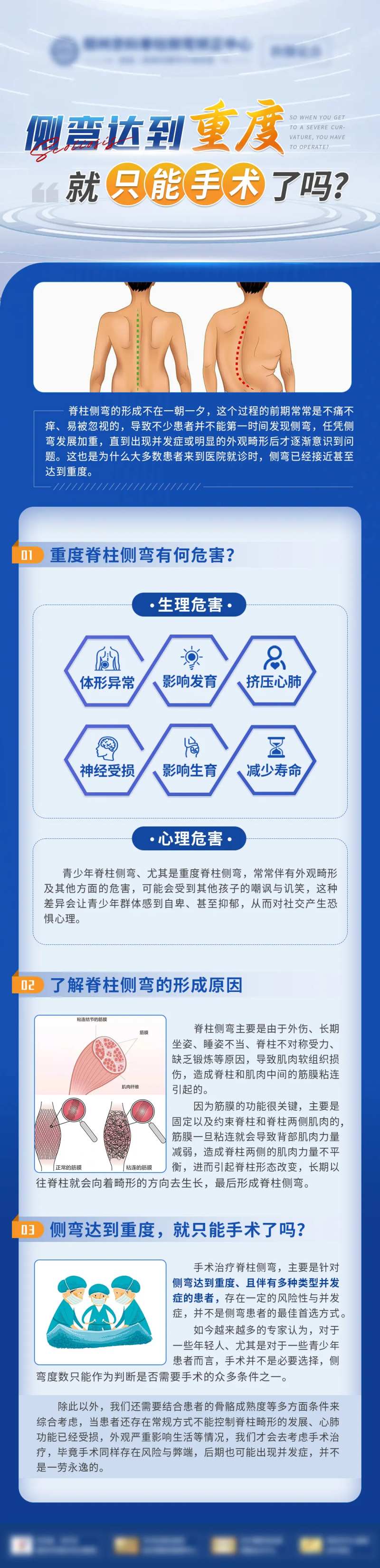 重度侧弯科普 -采灵感-cailinggan.com