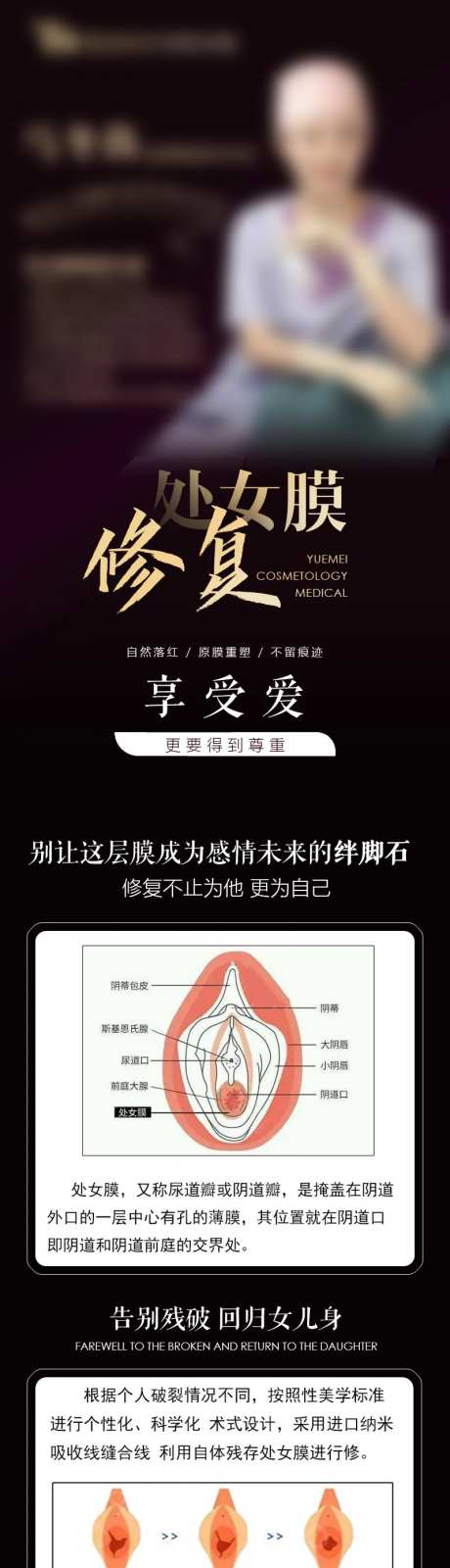 私密修复-采灵感-https://www.cailinggan.com/