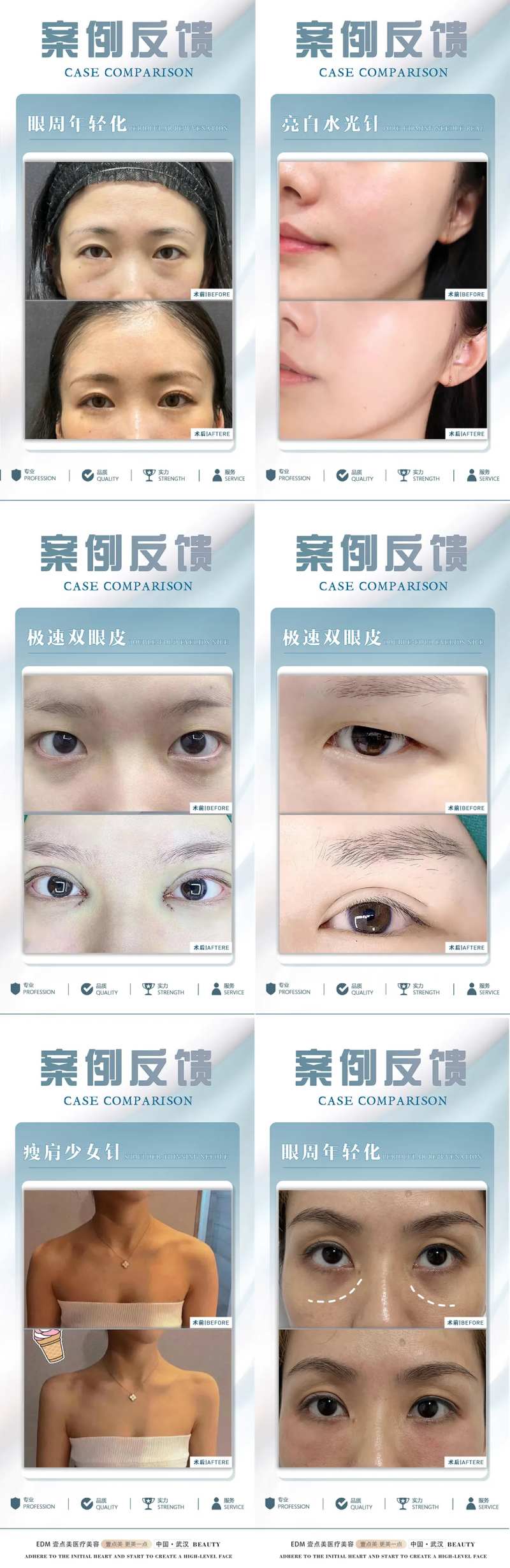 医美整形案例-采灵感-cailinggan.com