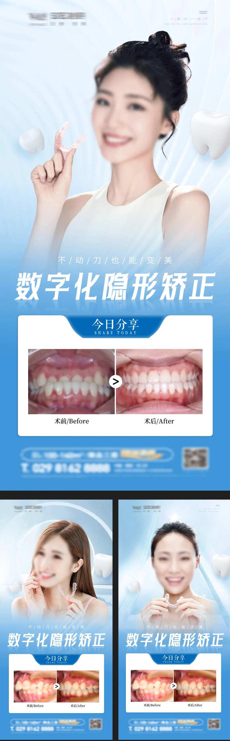 口腔牙齿矫正案例i对比系列宣传海报-采灵感-cailinggan.com
