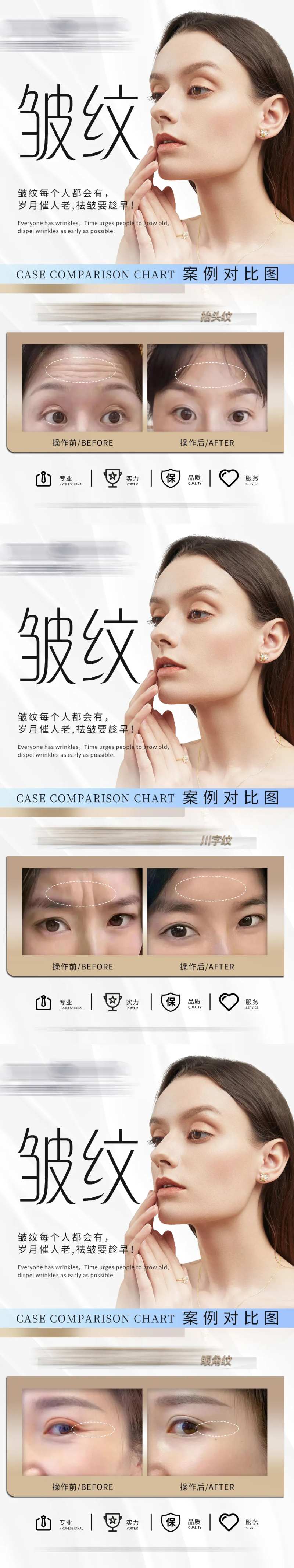  医美祛皱案例对比图海报-采灵感-cailinggan.com
