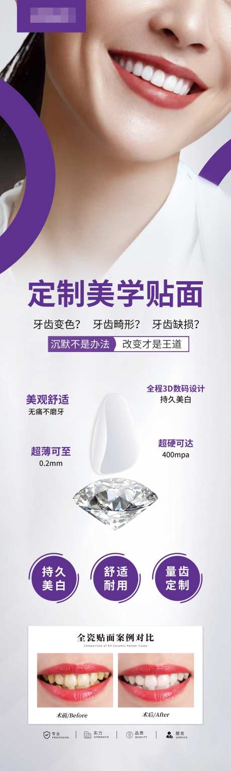 牙齿贴面海报-采灵感-https://www.cailinggan.com/