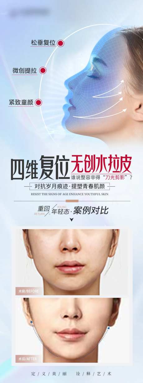 医美全面部拉皮案例海报-采灵感-https://www.cailinggan.com/