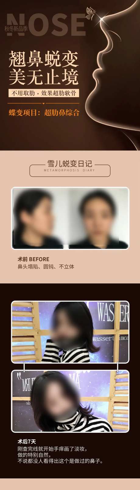 大气超肋隆鼻案例长图海报-采灵感-https://www.cailinggan.com/
