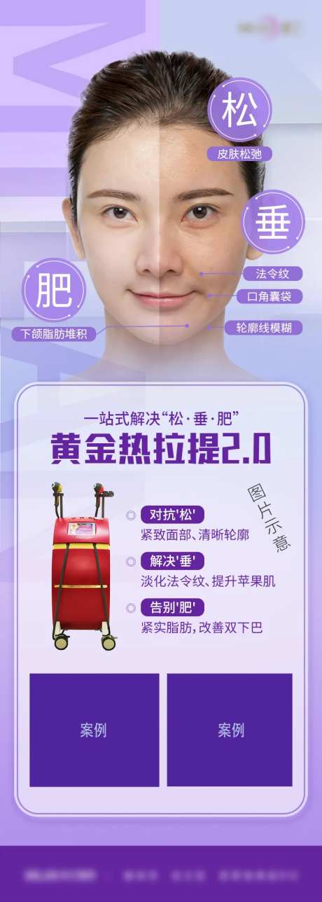 黄金热拉提-采灵感-https://www.cailinggan.com/