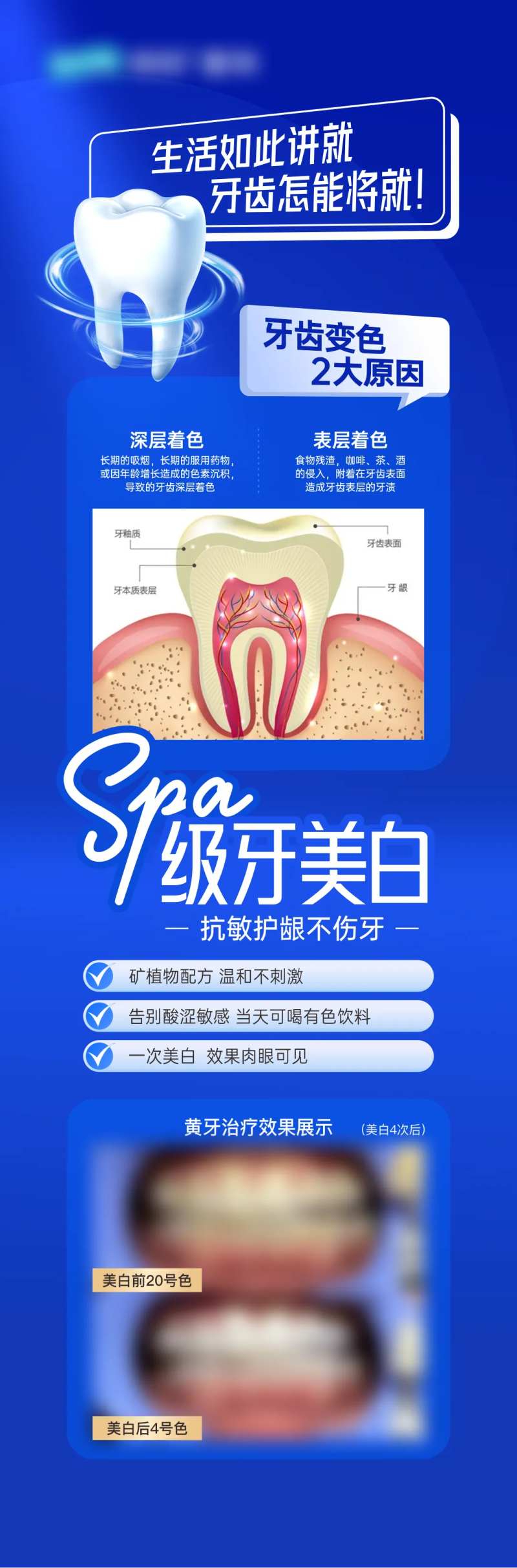 美白牙齿-采灵感-cailinggan.com