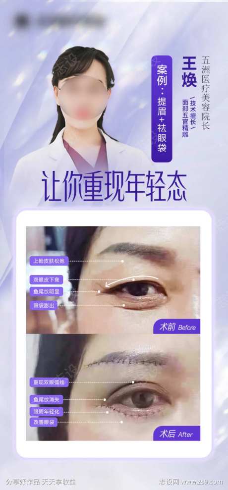 提眉祛眼袋海报（TIF用PS打开）-采灵感-https://www.cailinggan.com/