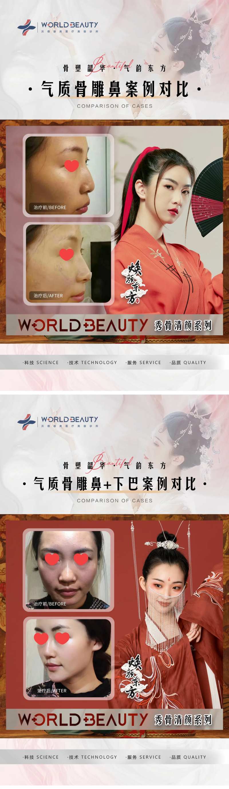 医美古风美女案例对比-采灵感-cailinggan.com