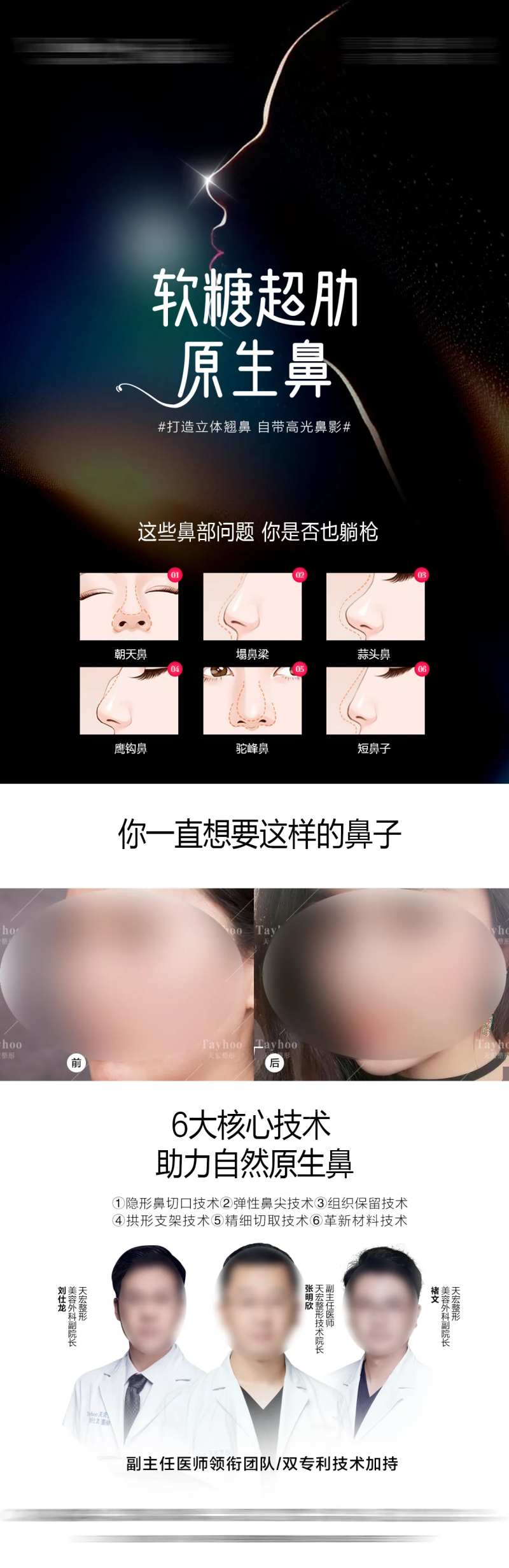 原生鼻-采灵感-cailinggan.com