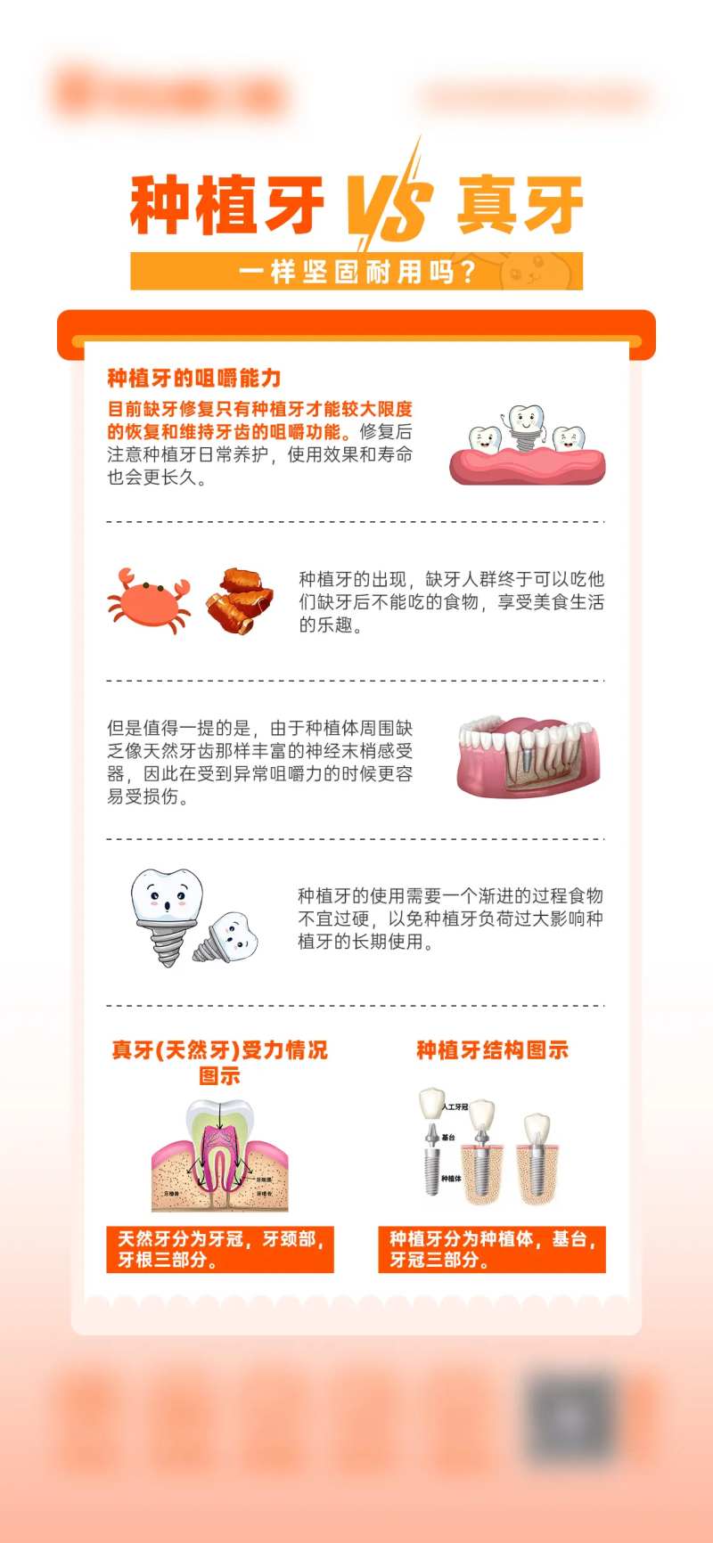 种植牙VS真牙-采灵感-cailinggan.com