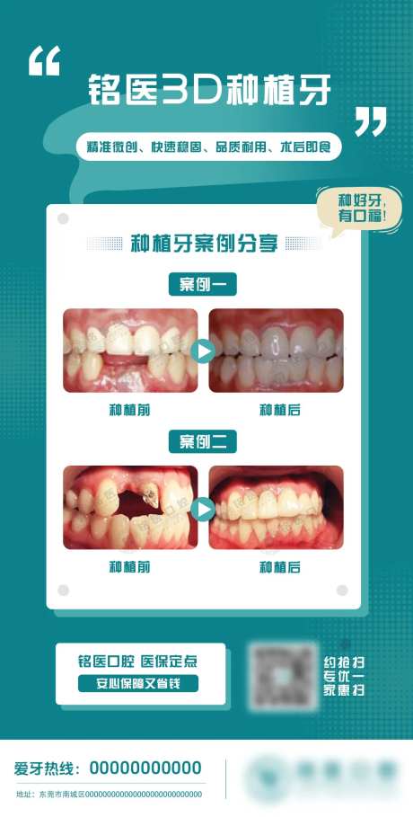 种植牙案例分享海报-采灵感-https://www.cailinggan.com/