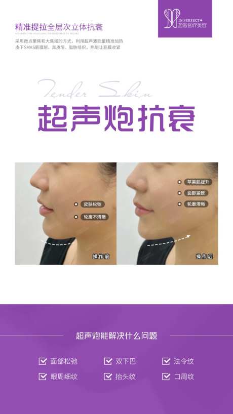 超声炮对比案例海报-采灵感-https://www.cailinggan.com/