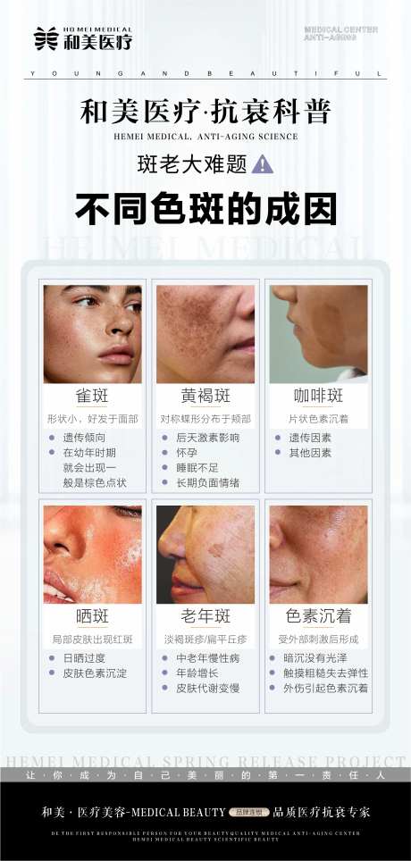 不同色斑的成因-采灵感-https://www.cailinggan.com/