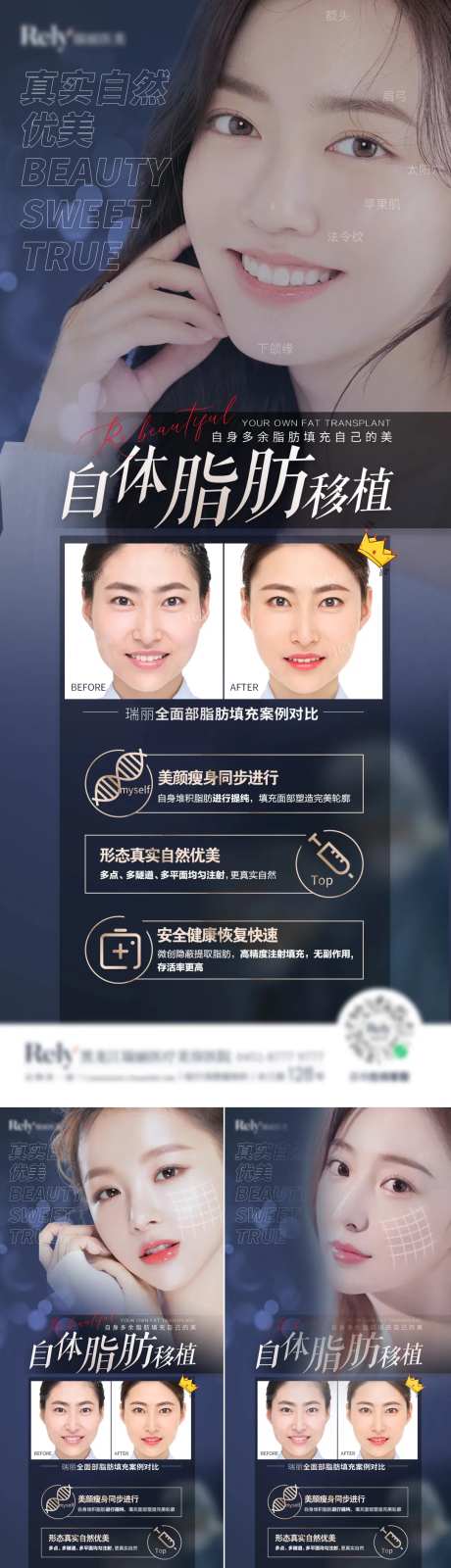医美脂肪填充系列海报-采灵感-https://www.cailinggan.com/