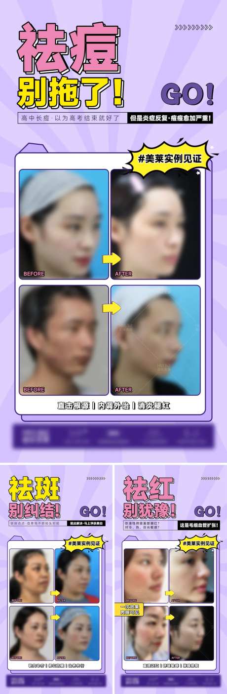 医美网红风小红书案例海报-采灵感-https://www.cailinggan.com/