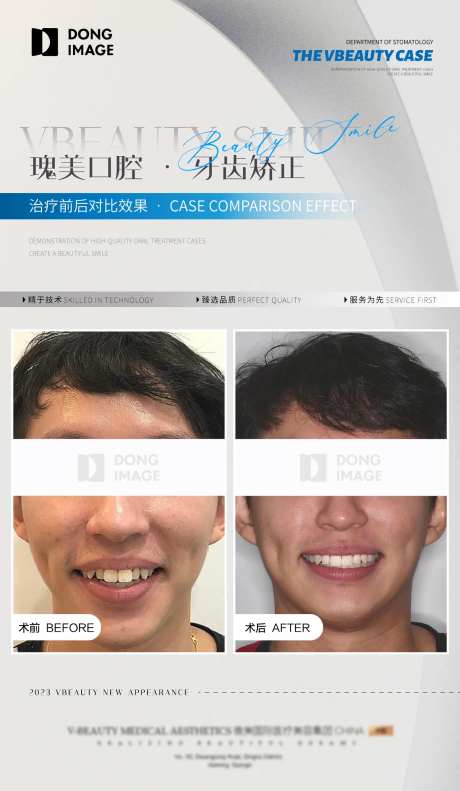 口腔牙科矫正案例对比宣传海报-采灵感-https://www.cailinggan.com/