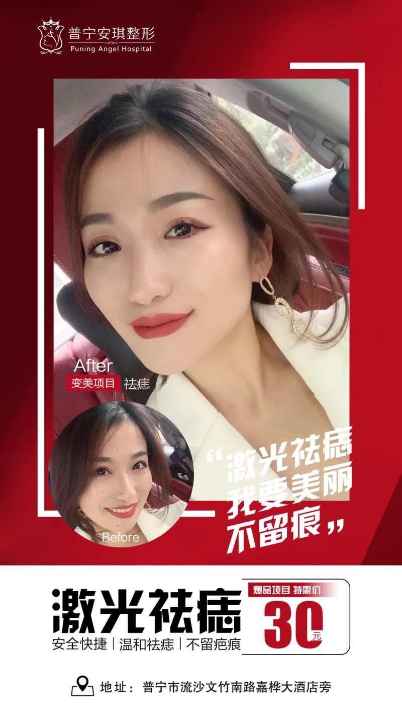 祛痣医美整形海报-采灵感-cailinggan.com
