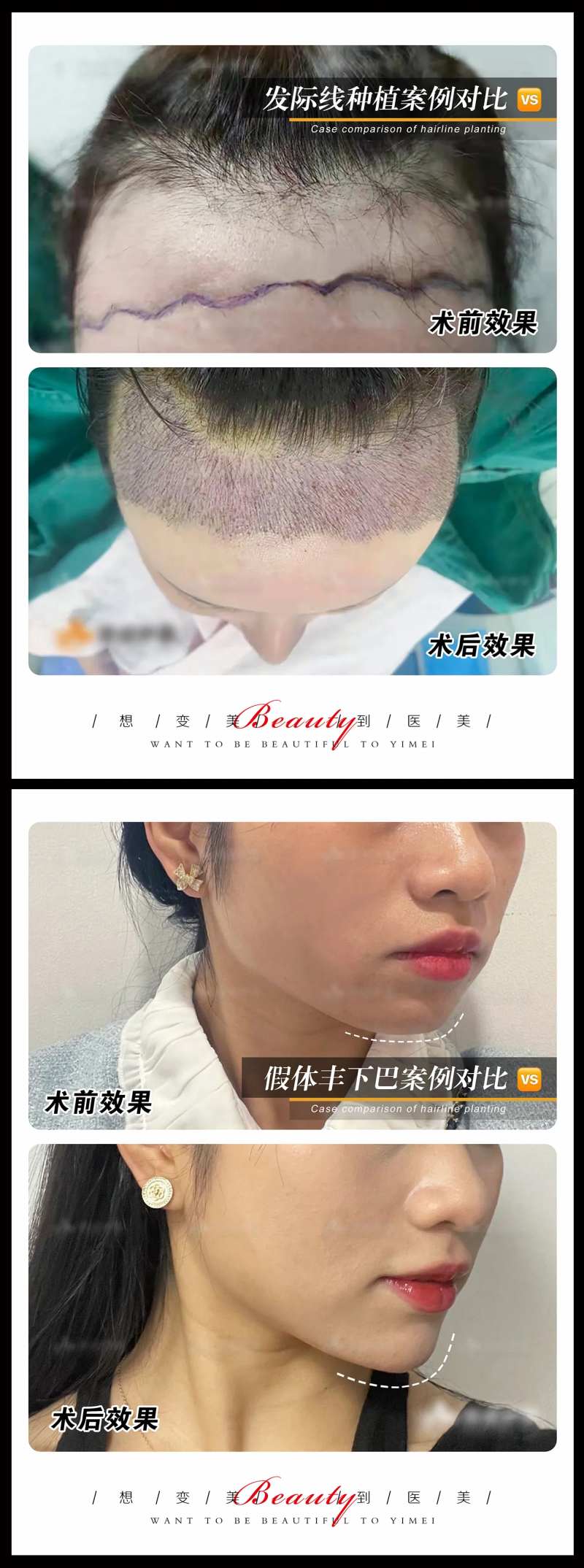 医美案例模板系列海报-采灵感-cailinggan.com