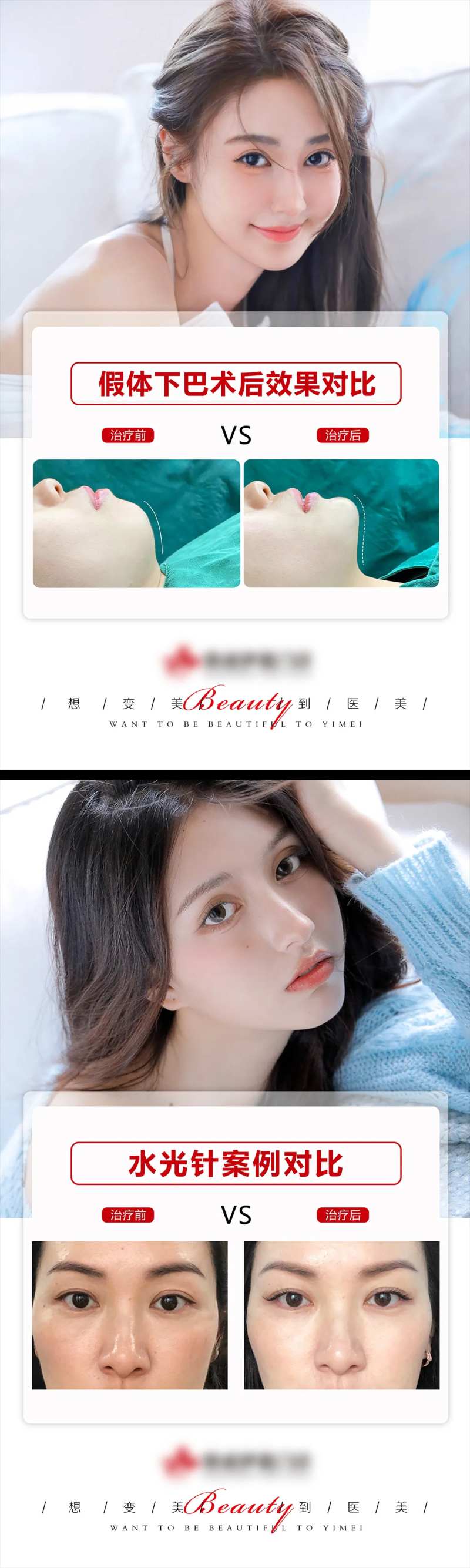 医美案例模板-采灵感-cailinggan.com