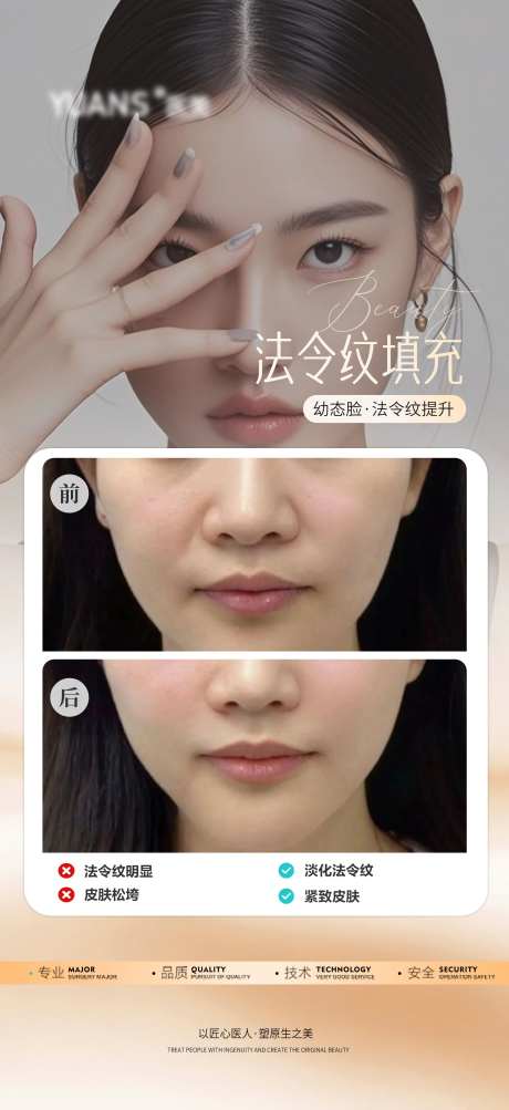 医美法令纹填充案例-采灵感-https://www.cailinggan.com/