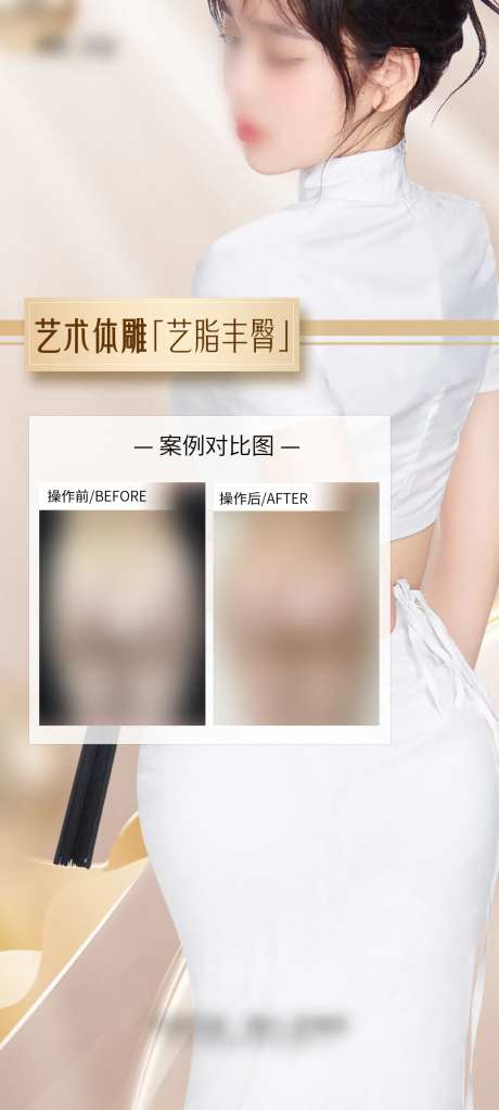 医美丰臀案例海报-采灵感-https://www.cailinggan.com/