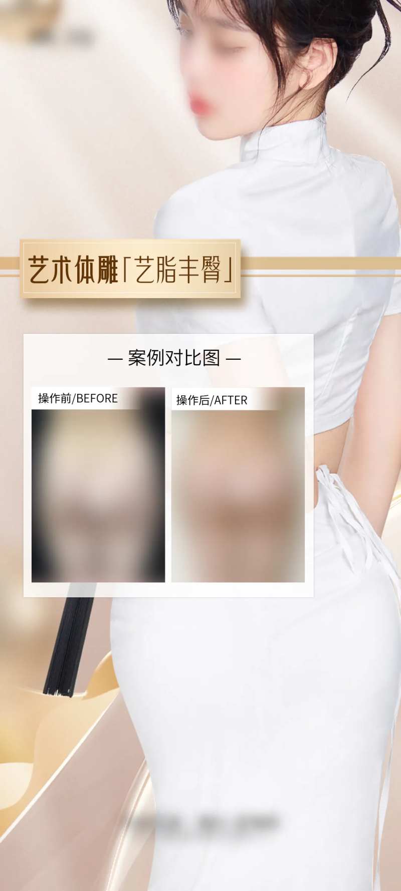 医美丰臀案例海报-采灵感-cailinggan.com