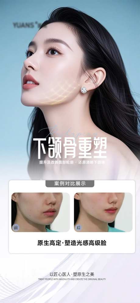 医美下颌缘提升案例海报-采灵感-https://www.cailinggan.com/