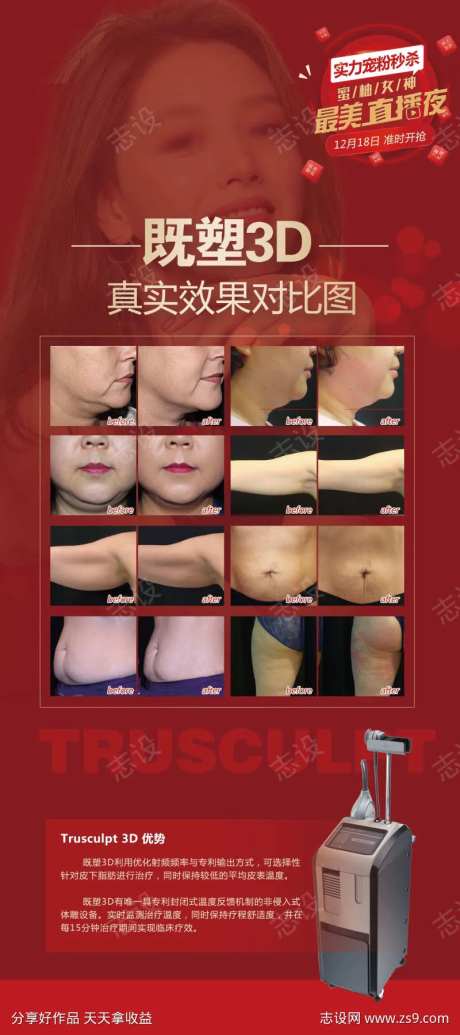 效果对比展架-采灵感-https://www.cailinggan.com/