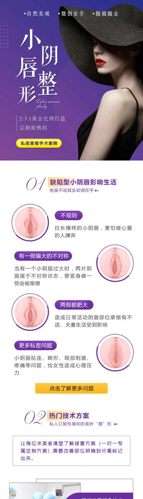 私密小阴唇整形-采灵感-https://www.cailinggan.com/