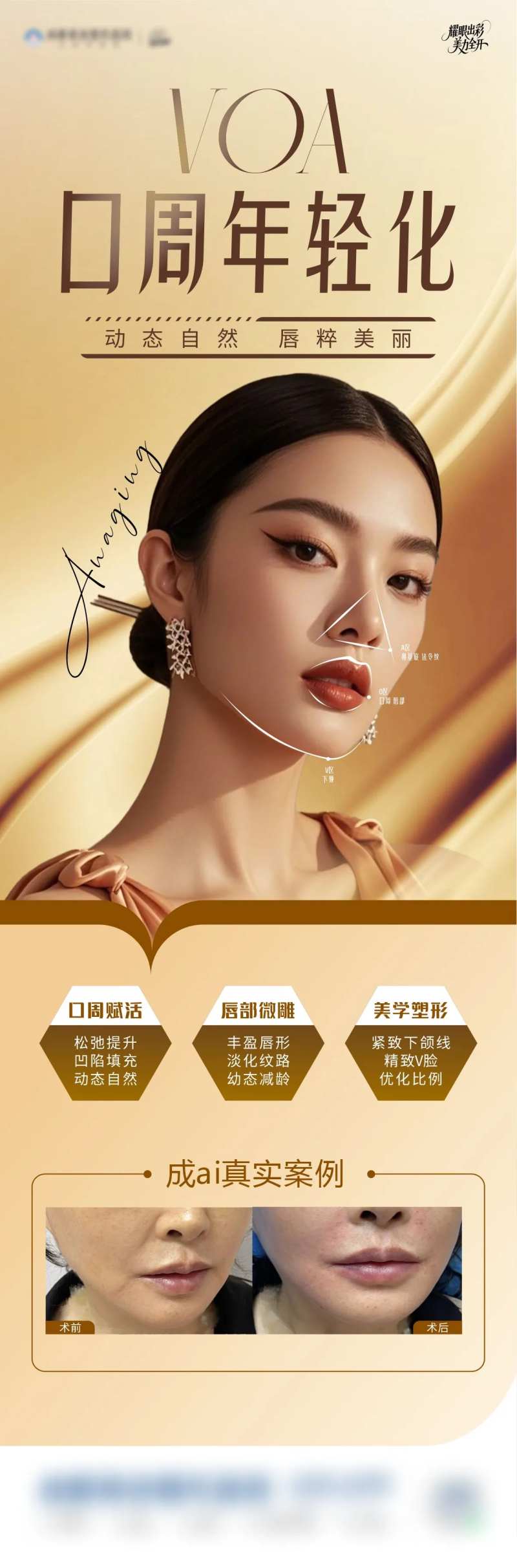 VOA口周年轻化-采灵感-cailinggan.com
