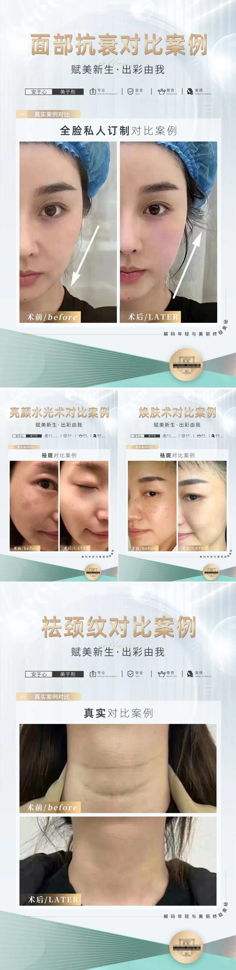医美真实对比图-采灵感-cailinggan.com