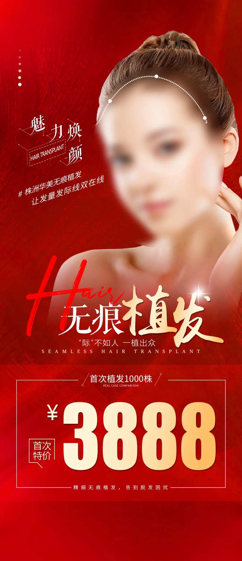 无痕植发价格海报-采灵感-cailinggan.com