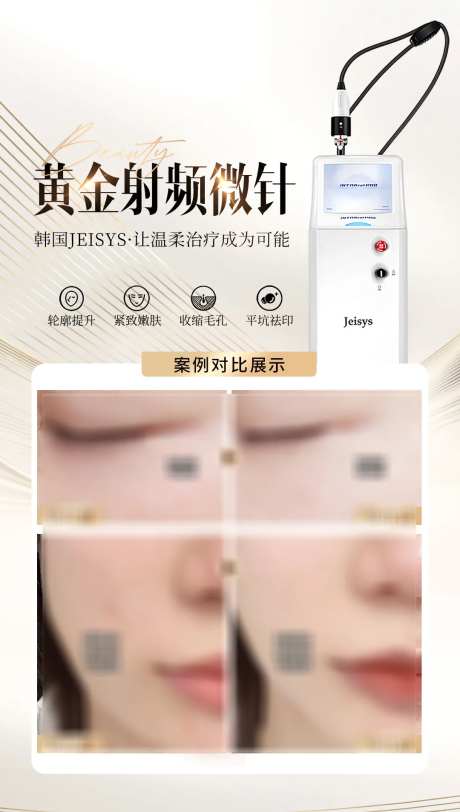 医美黄金射频微针案例海报-采灵感-https://www.cailinggan.com/