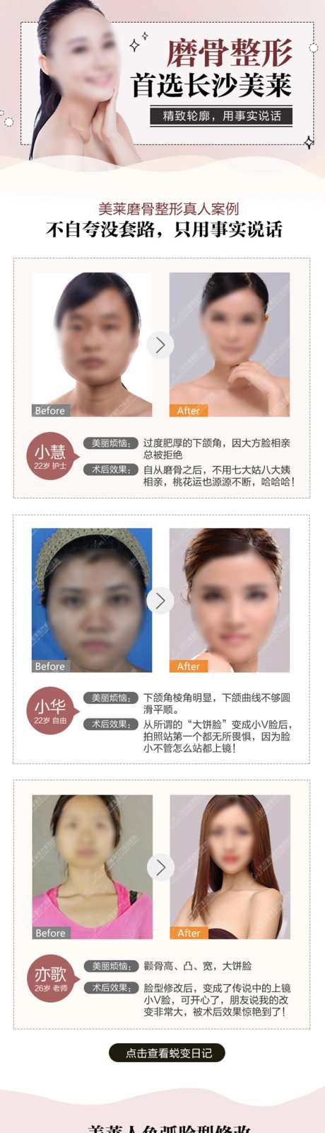 医美磨骨效果详情页-采灵感-https://www.cailinggan.com/