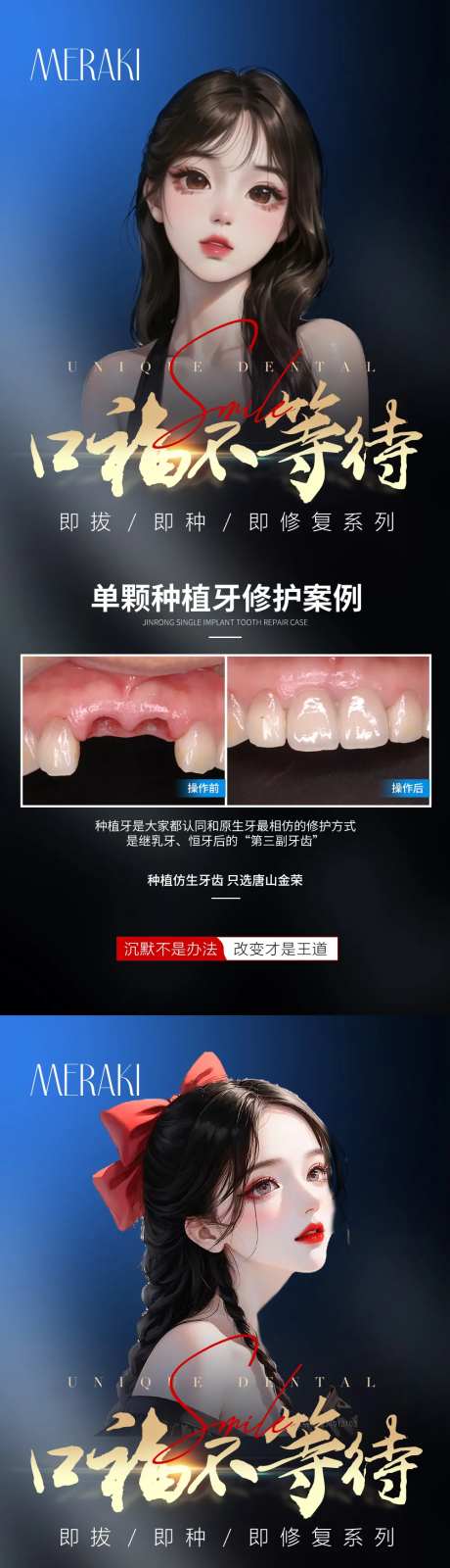 医美牙齿种植系列海报-采灵感-https://www.cailinggan.com/