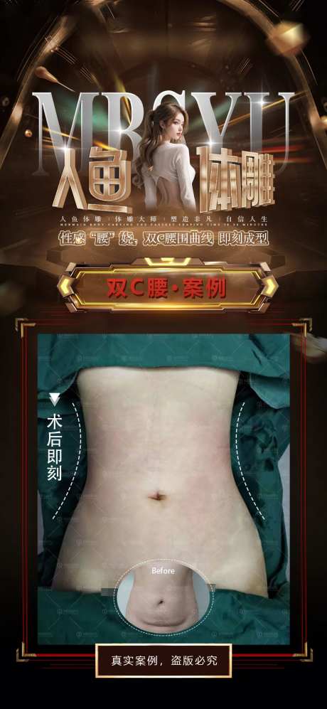 人鱼体雕腰腹对比图宣传海报-采灵感-https://www.cailinggan.com/