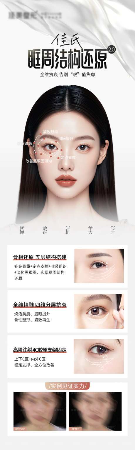 眶周结构还原-采灵感-https://www.cailinggan.com/