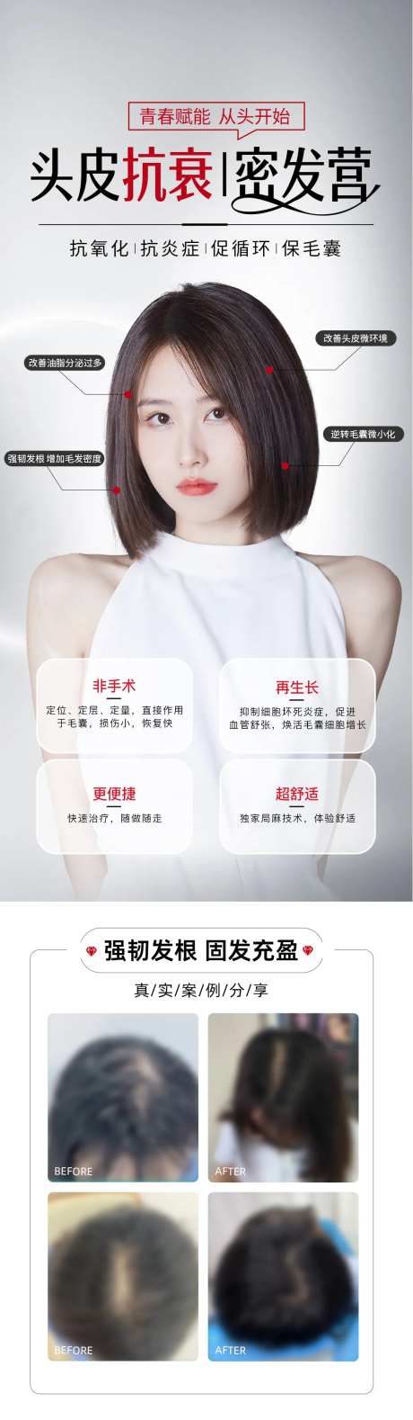 3d头发抗衰植发案例落地页-采灵感-https://www.cailinggan.com/
