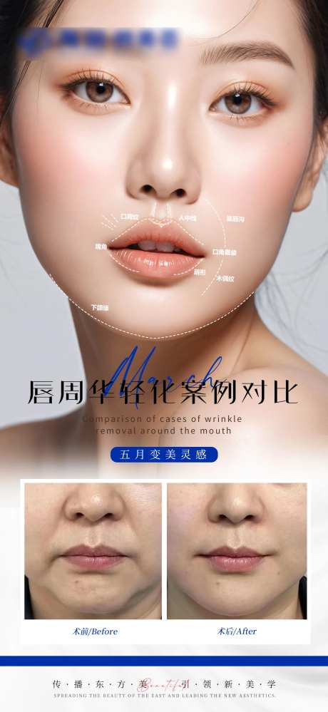 医美唇周抗衰案例对比海报-采灵感-https://www.cailinggan.com/
