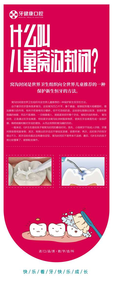 窝沟封闭海报-采灵感-https://www.cailinggan.com/
