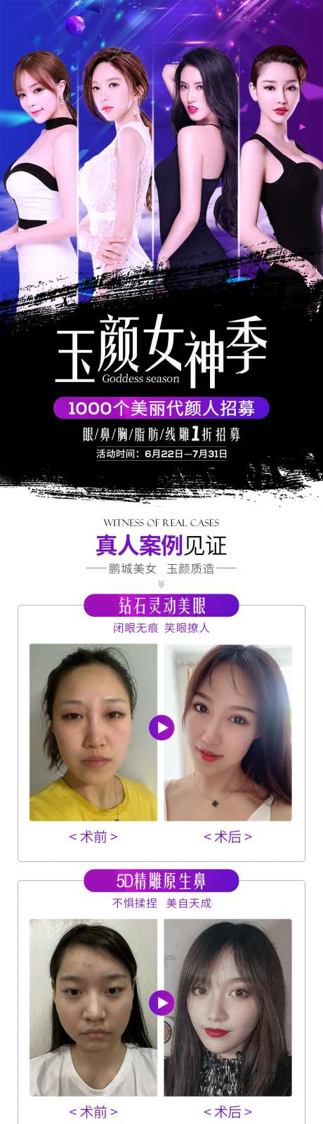 美容整形模特招募长图海报                                                                                                                                                                                            -采灵感-https://www.cailinggan.com/