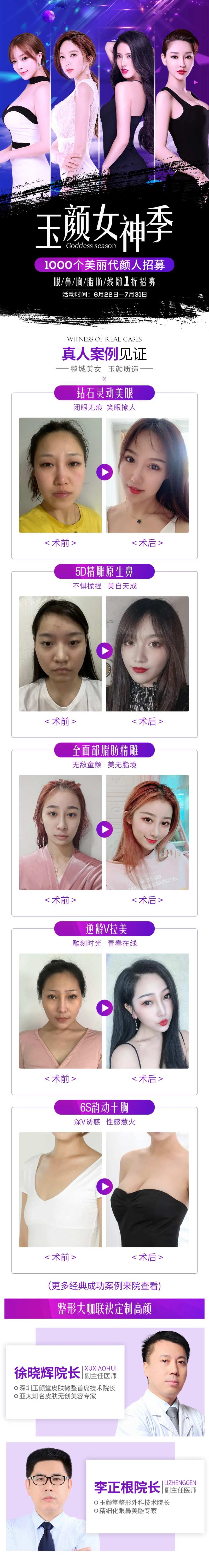 美容整形模特招募长图海报                                                                                                                                                                                            -采灵感-cailinggan.com
