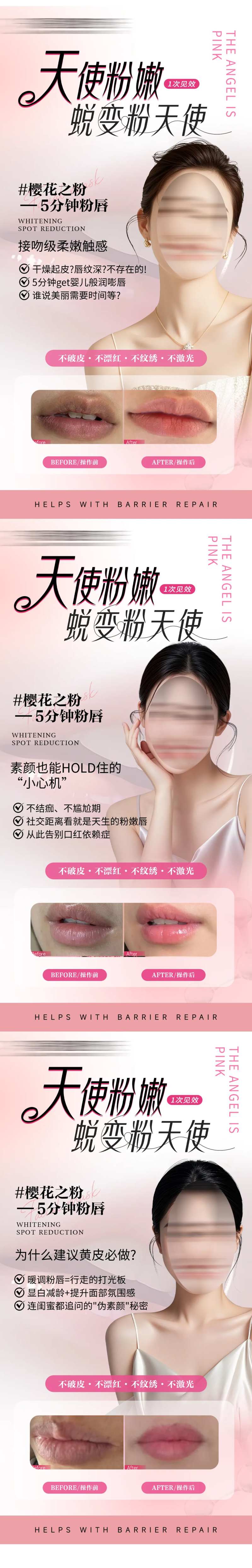 私密粉嫩嘴唇飘红粉嫩医美美业粉嫩-采灵感-cailinggan.com