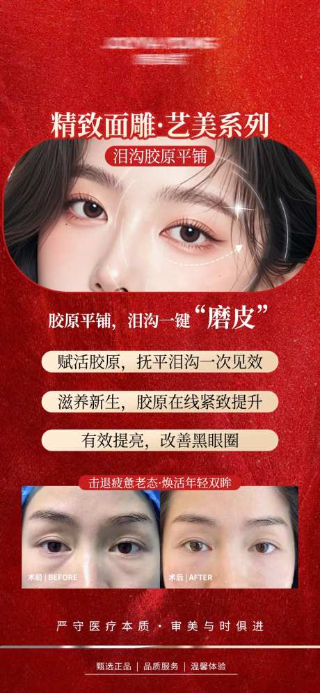 医美泪沟海报-采灵感-https://www.cailinggan.com/